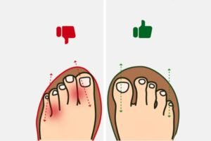 Barefoot Shoes for pain